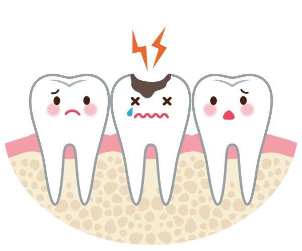 How To Alleviate Tooth Pain